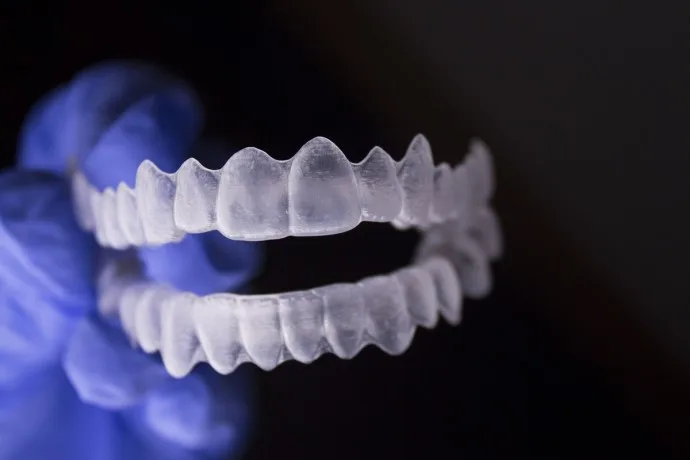 Invisible Braces Ottawa