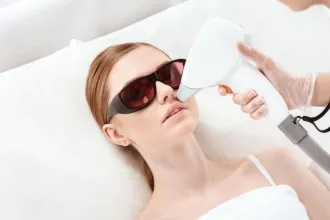 épilation laser