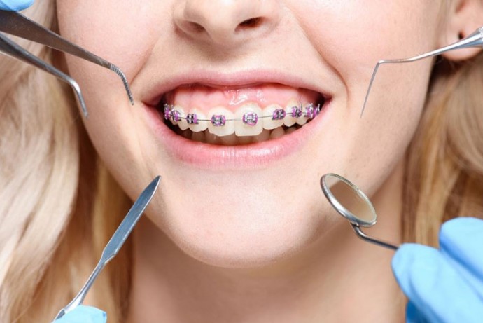 Orthodontists Ottawa